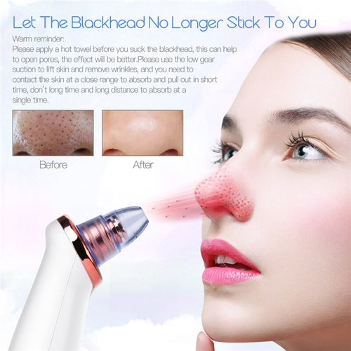Vacuum Blackhead Remover Tool