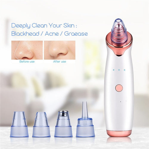 Vacuum Blackhead Remover Tool
